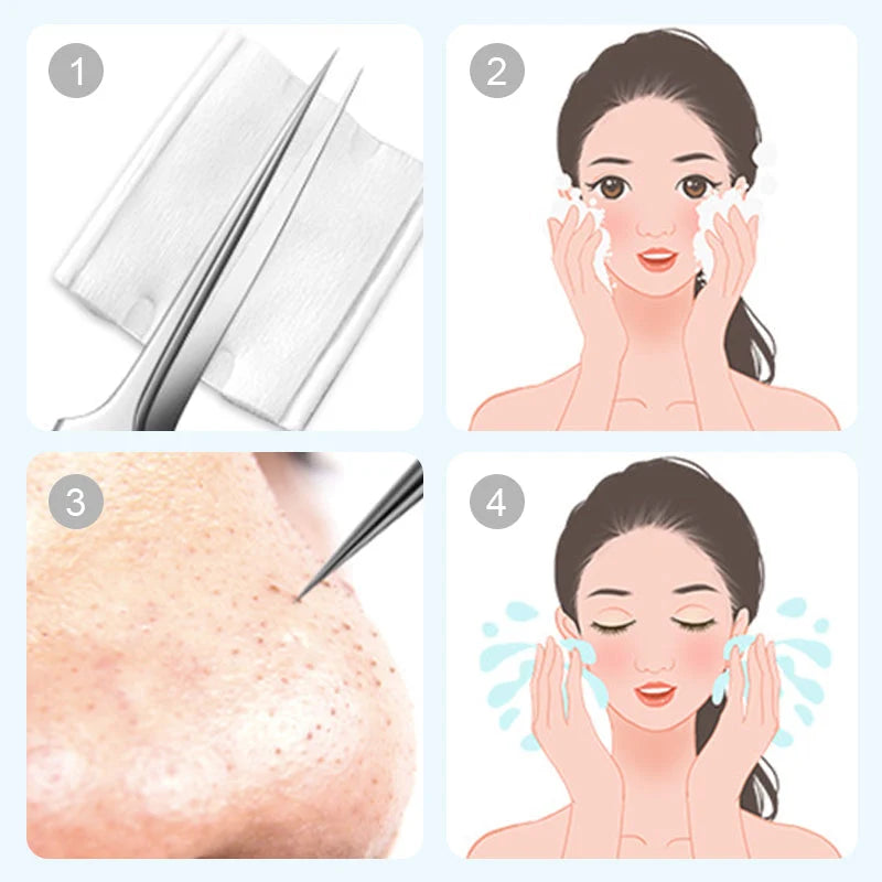 Blackhead & Pimple Remover Kit – Clean Pores, Remove Blackheads & Blemishes Easily