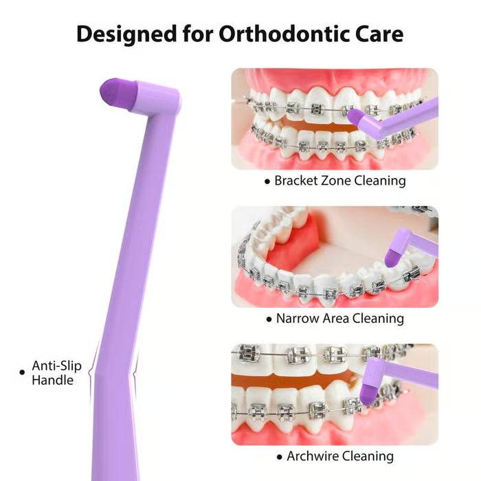 2-Pack Orthodontic Toothbrush – Soft Bristles for Braces